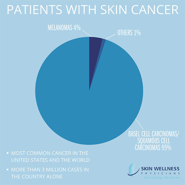 Learn more about the most common cancer, impacting millions of people in the United States alone. When it comes to skin cancer, Florida’s Skin Wellness Physicians encourages skin checks for early diagnosis of basal cell carcinoma, squamous cell carcinoma, and melanoma.